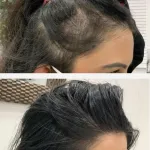 Foto do grupo Contra queda de cabelo